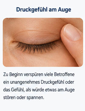 Symptome eines Gerstenkorns - Druckgefühl